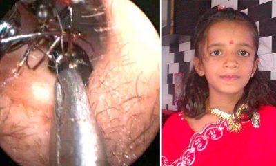 Shreya Darji 1000 formigas do ouvido