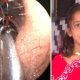 Shreya Darji 1000 formigas do ouvido