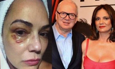 MP recusa vídeo de Luiza Brunet com Parisotto gravado por ela após agressão