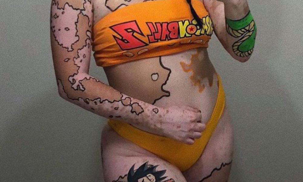 Como resposta à bullying que sofria, jovem com vitiligo transforma seu corpo em obra de arte e fica famosa / Foto : Reprodução Ashley Soto / Instagram