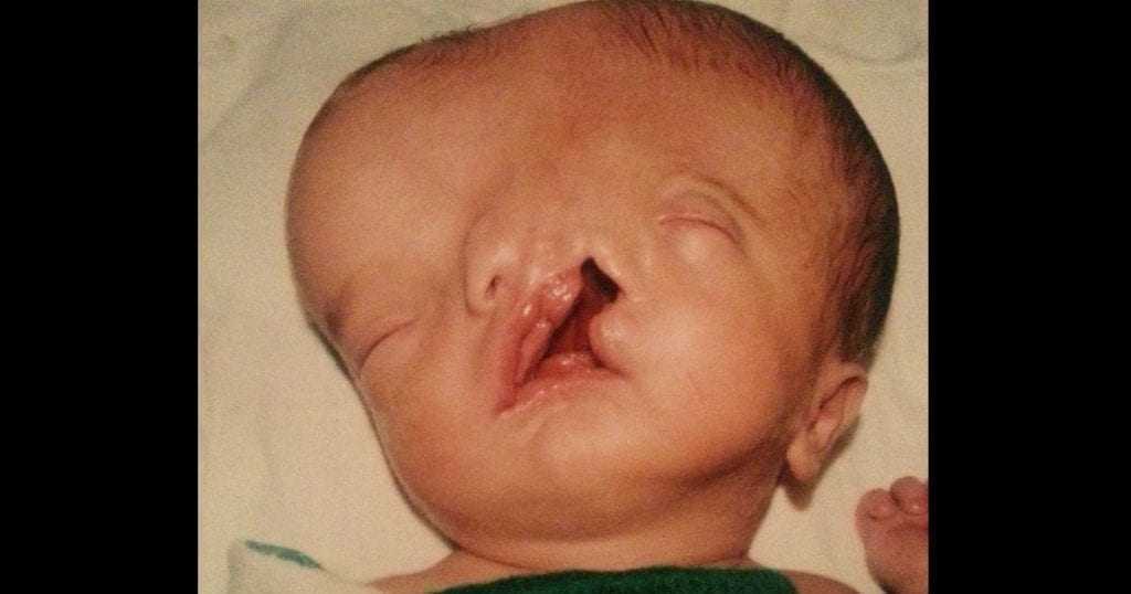 Foto: Reprodução Facebook – Confira a emocionante história deste bebê que superou todas as expectativas