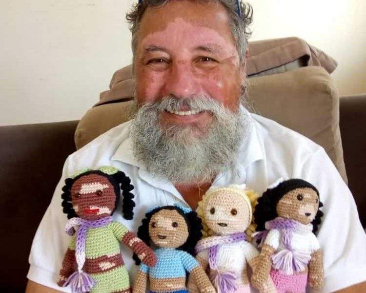 Um avô amoroso cria bonecas com vitiligo para que sua pequena neta possa brincar