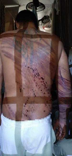 Presos mostram costas repletas de cortes após "salve" / Foto : Divulgação