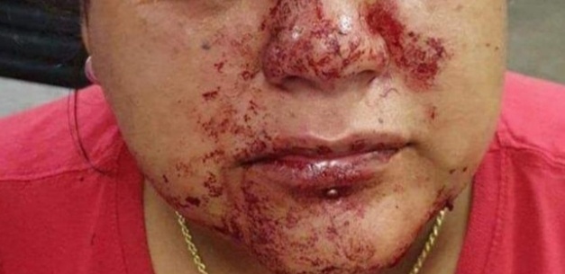 Jornalista denuncia motorista de aplicativo por agressão em Manaus