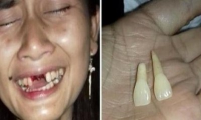 Homem não aceita término e arranca 2 dentes da namorada