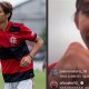 Amazonense do Flamengo e da Seleção conta como foi sua participação na briga no fim da partida contra o Vasco