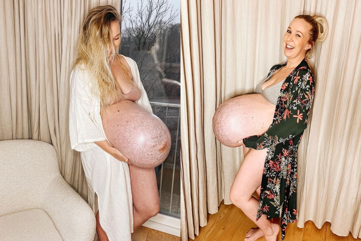 Barriga de grávida maceta chama a atenção de internautas