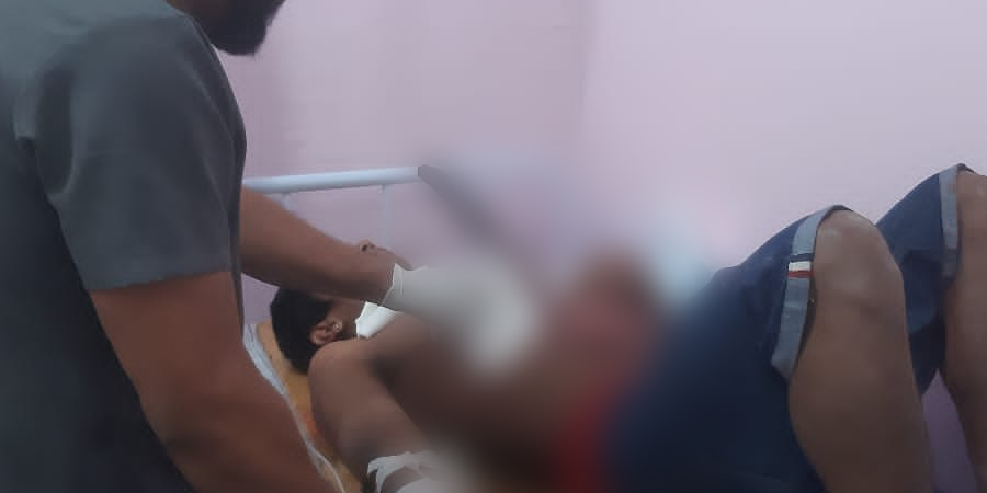 Cenas Fortes: Briga de terçados faz vítima fatal em Maraã. Homem ficou com as tripas pra fora!