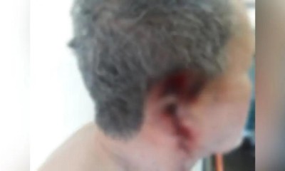 Homem corta com facão orelha de cunhado para tirar gosto com cachaça