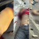 Vídeo 18+: Homem tem braço arrancado durante grave acidente em frente ao "Baratão"