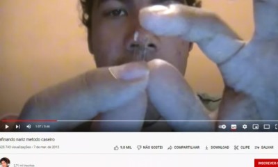 Vídeo: Jovem tenta fazer sozinho uma plástica caseira no nariz e acaba no hospital