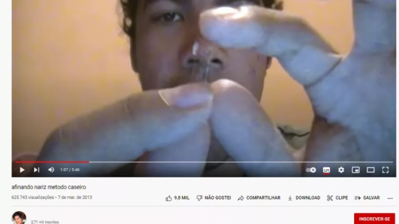 Vídeo: Jovem tenta fazer sozinho uma plástica caseira no nariz e acaba no hospital
