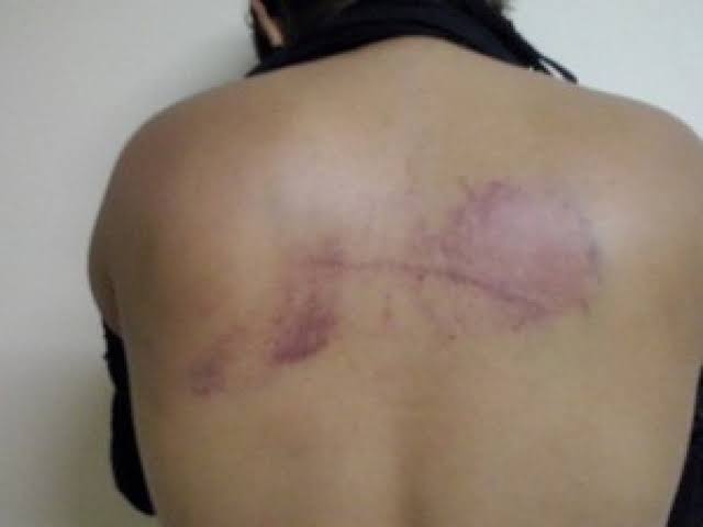 Esposa é agredida após flagrar o marido com amiga pelados na cama