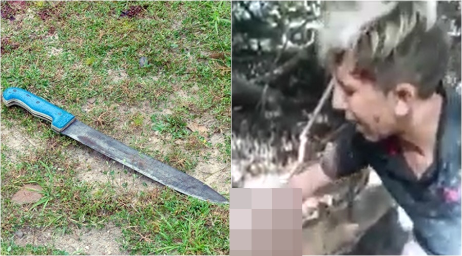 Vídeo +18: Sem dó nem piedade, bandidos arrancam dedo de menina com facão!