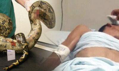 Paraense quase morre ao enfiar uma jiboia no seu orifício anal