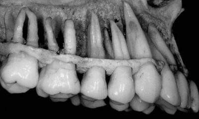 Conheça o tamanho verdadeiro dos dentes!