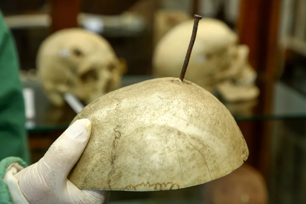 Crânio exposto no Museu do IML, no Paraná — Foto: Giuliano Gomes/PR Press