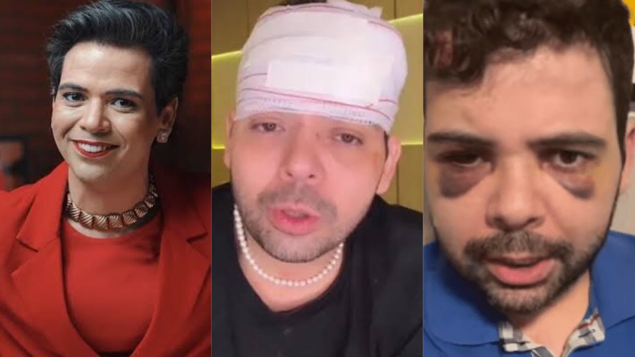 Polícia mineira nega que humorista Gustavo Mendes tenha sofrido tentativa de assalto