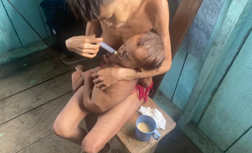 Crianças yanomami sofrem com desnutrição — Foto: Júnior Hekurari/Arquivo Pessoal
