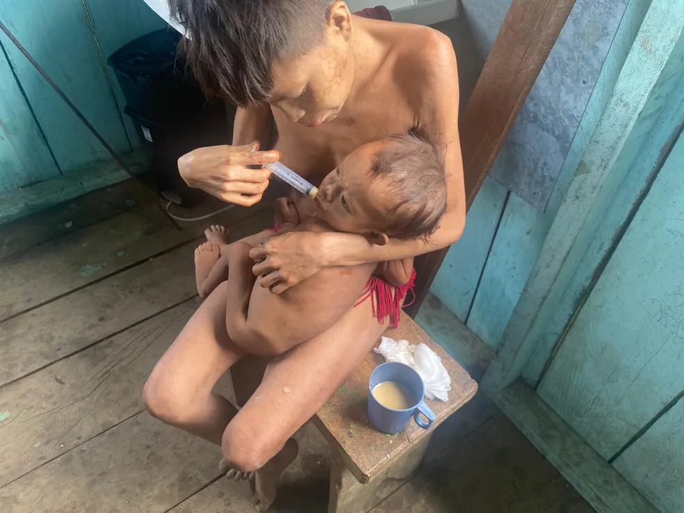 Crianças yanomami sofrem com desnutrição — Foto: Júnior Hekurari/Arquivo Pessoal

