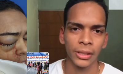 Irmão da Vítima acidentada na Barraca de Tiro Ao Alvo em Arraial de Manaus grava vídeo e faz apelo