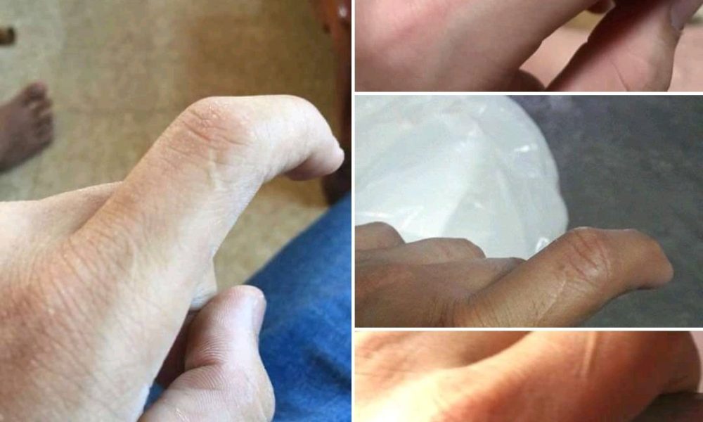 Saiba o significado de uma cicatriz no dedo esquerdo!