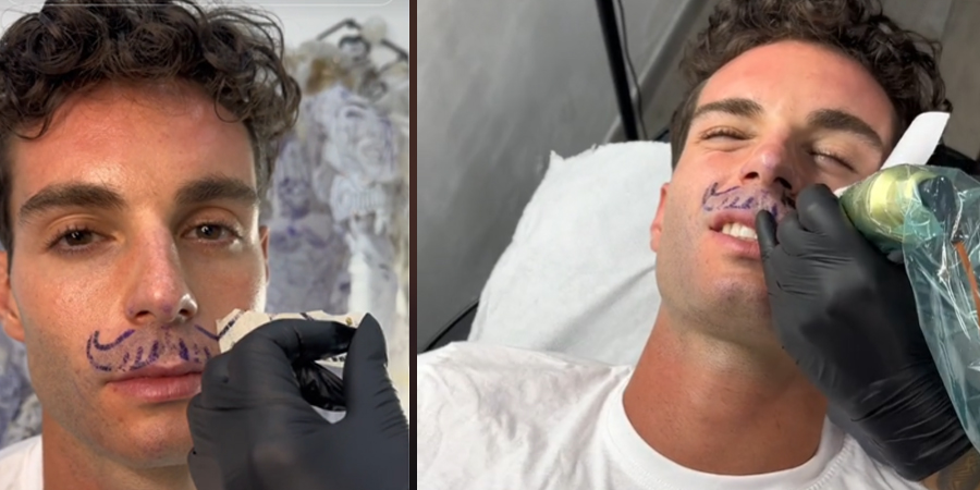 Vídeo Viral: Homem tatua bigode permanente e viraliza na web