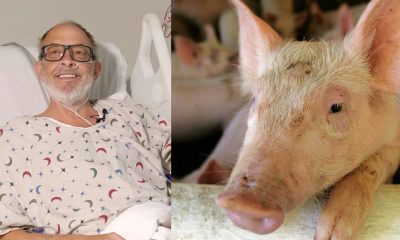 Homem que estava em estado terminal e recebeu doação de coração de porco, segue firme e forte após 1 mês transplantado / Centro Médico da Universidade de Maryland