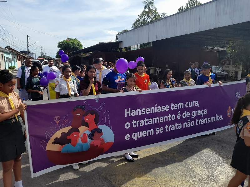 Prefeitura de Manaus encerra o Janeiro Roxo, de combate à hanseníase, com caminhada na zona Leste / Foto - Divulgação/Semsa