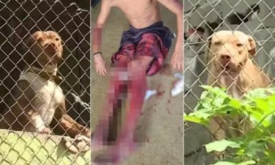 Dois pitbulls dilaceram perna de garoto de 12 anos e mataram cadela que estava perto dele