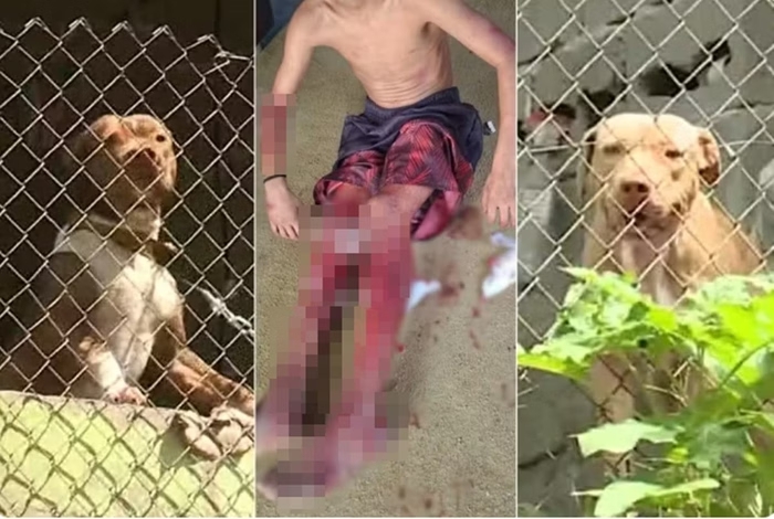 Dois pitbulls dilaceram perna de garoto de 12 anos e mataram cadela que estava perto dele