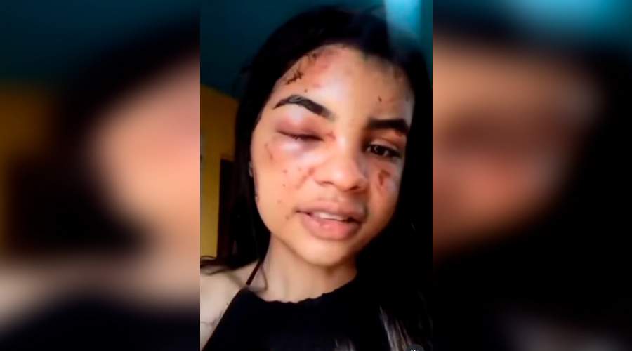 Jovem se recusa a sair com rapaz que conheceu em adega e sofre violência brutal!