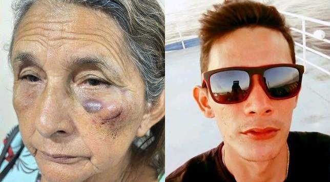 Idosa de 72 anos é agredida pelo próprio filho em Parintins e caso revolta vizinhança