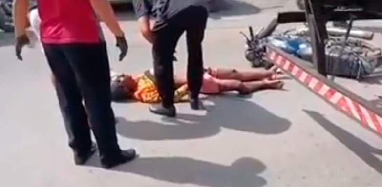 Vídeo : Após colisão forte, motociclista fica com pulmão exposto