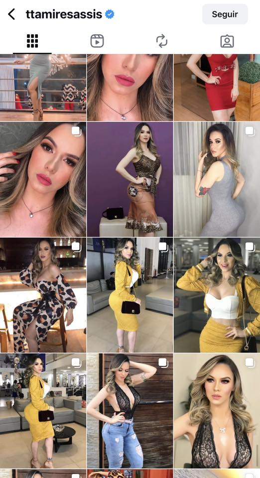 Tamires Assis antes e depois / foto : Reprodução Redes Sociais