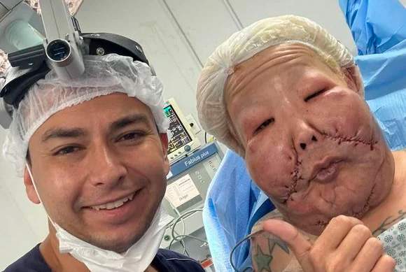 Confira as primeiras fotos da Juju do Pix após a cirurgia de remoção do óleo mineral do seu rosto / Foto : Divulgação