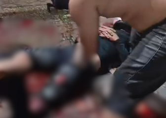 vÍdeo motociclista sofre ferimento gravíssimo após colisão no vieiralves e corre risco de amputação