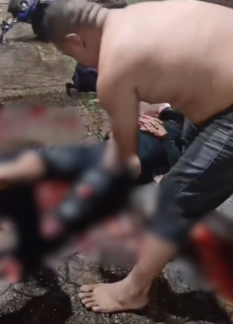 vÍdeo motociclista sofre ferimento gravíssimo após colisão no vieiralves e corre risco de amputação
