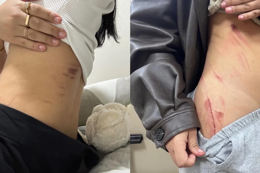 casal lésbico é vítima de assalto e violência sexual no df; suspeito acaba preso
